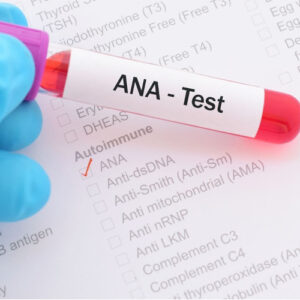 https://chroneva.com/wp-content/uploads/2022/03/Anti-Nuclear-Antibody-ANA-300x300.jpg