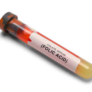 https://chroneva.com/wp-content/uploads/2022/03/Folate-Serum-Folic-Acid-300x300.jpg