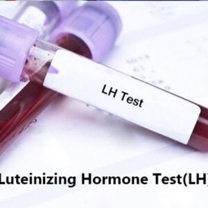 https://chroneva.com/wp-content/uploads/2022/03/Luteinising-Hormone-LH-300x300.jpg