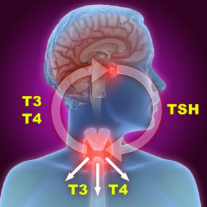 https://chroneva.com/wp-content/uploads/2022/03/Thyroid-Panel-II-TSH-TT3-TT4-FT3-FT4-300x300.jpg