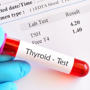 https://chroneva.com/wp-content/uploads/2022/03/Thyroid-Panel-–-IV-FT3-FT4-TSH-300x300.jpg