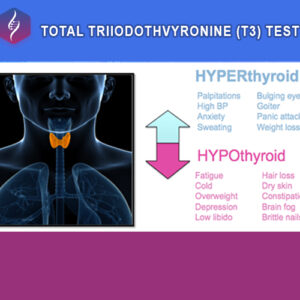 https://chroneva.com/wp-content/uploads/2022/03/Tri-Iodothyronine-Total-TT3--300x300.jpg