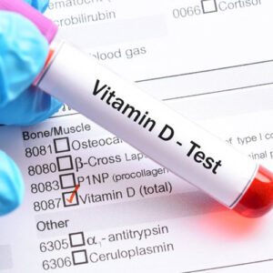 https://chroneva.com/wp-content/uploads/2022/03/Vitamin-D-3-25-–-Hydroxy-300x300.jpg